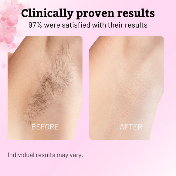 Nudora Beauty Cyperus Rotundus Oil product