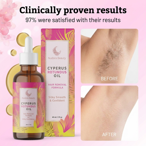 Cyperus Rotundus Oil for Hair Reduction
